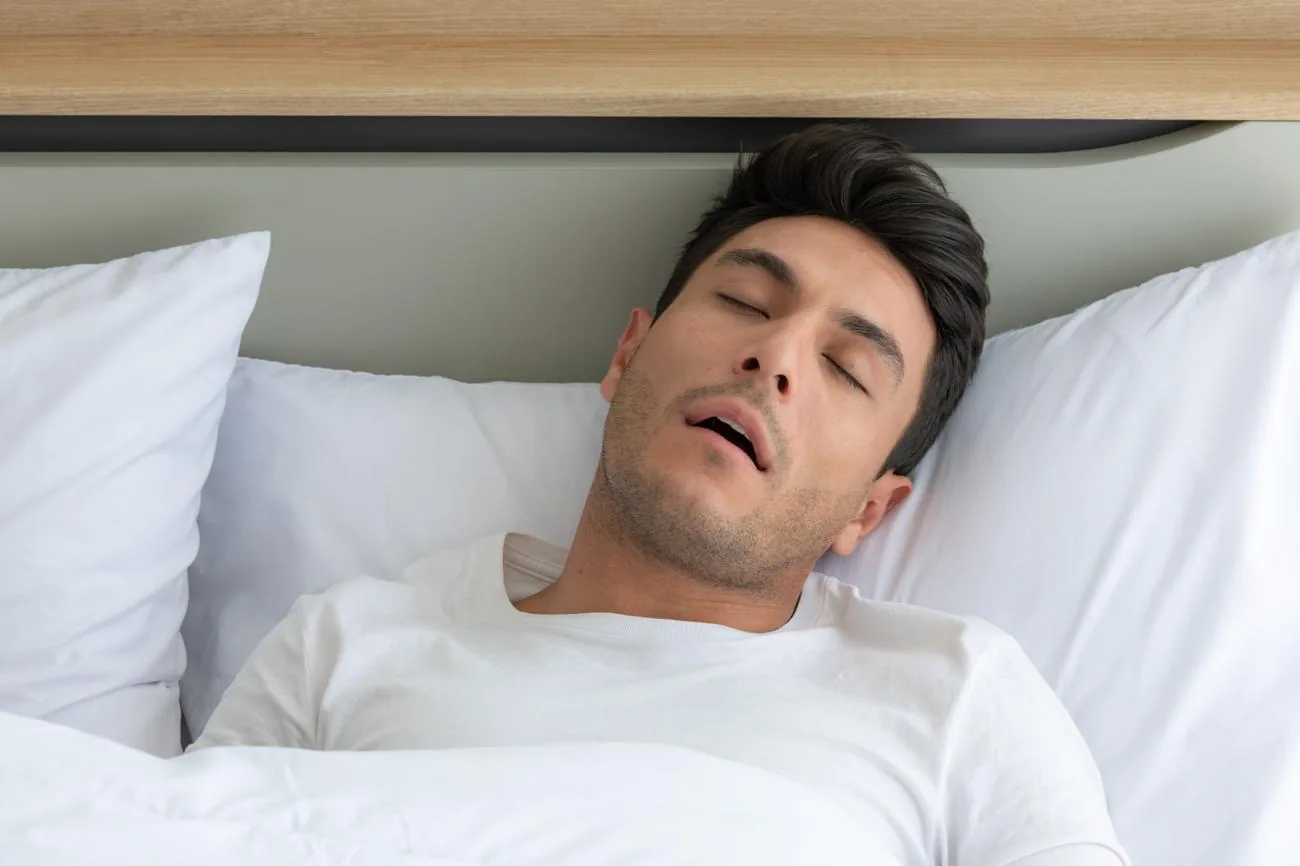 Le syndrome d’apnées du sommeil Homme dormant bouche ouverte, signe évocateur d’apnées du sommeil